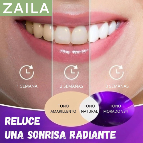 DiamondSmile™- Blanqueador Dental para una Sonrisa Deslumbrante